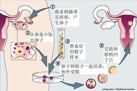 同性借卵助孕包生儿子